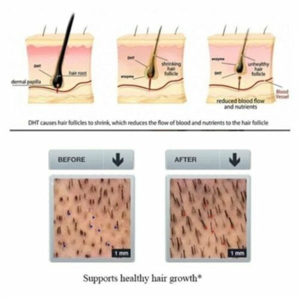 Hair Growth Essence Oil Herb Extract Repair Damaged Hair Nourish Hair Unisex Hair Care Regrowth Serum 2