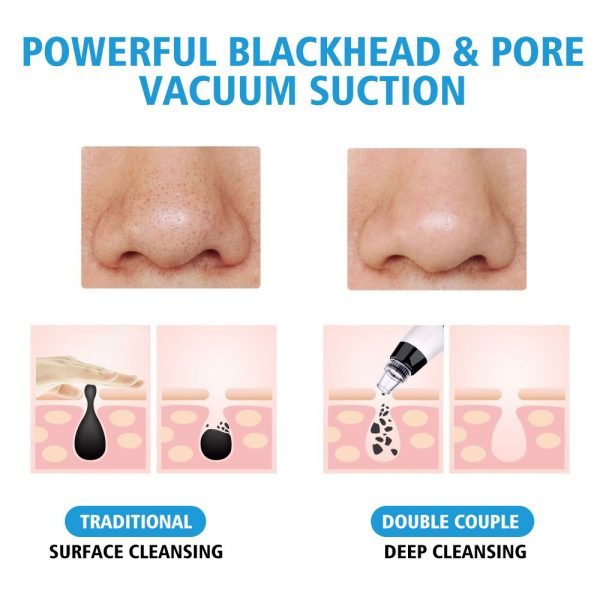Blackhead Vacuum Suction Pore Vacuum Cleaner Facial Blackhead Acne Removal Tools 3 Colors Light Photon Rejuvenation 2