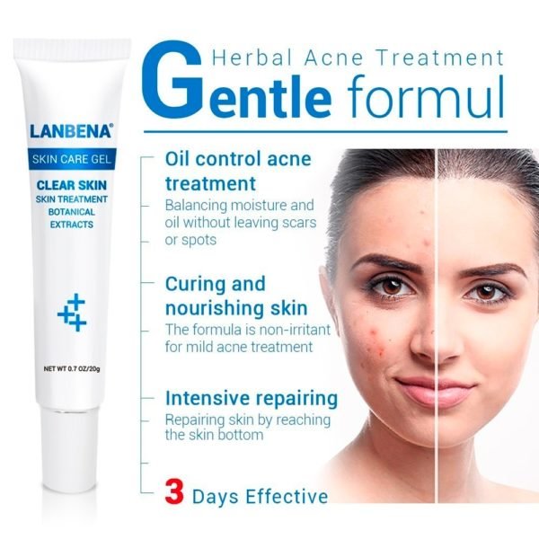 LANBENA Acne Treatment Cream Face Scar Removal Serum Anti Pimple Blemish Blackhead Spots Remover Gel Facial 1