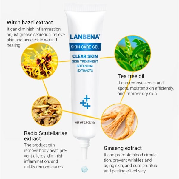 LANBENA Acne Treatment Cream Face Scar Removal Serum Anti Pimple Blemish Blackhead Spots Remover Gel Facial 3