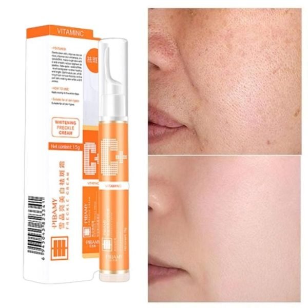 15ml Instant Blemish Removal Gel Vitamin C Whitening Anti Freckle Cream Pen Effective Remove the Freckle