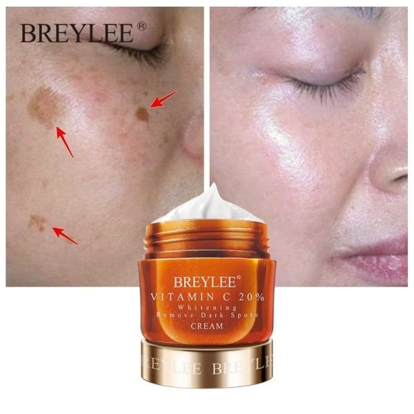 BREYLEE Vitamin C 20 VC Whitening Facial Cream Repair Fade Freckles Remove Dark Spots Melanin Remover