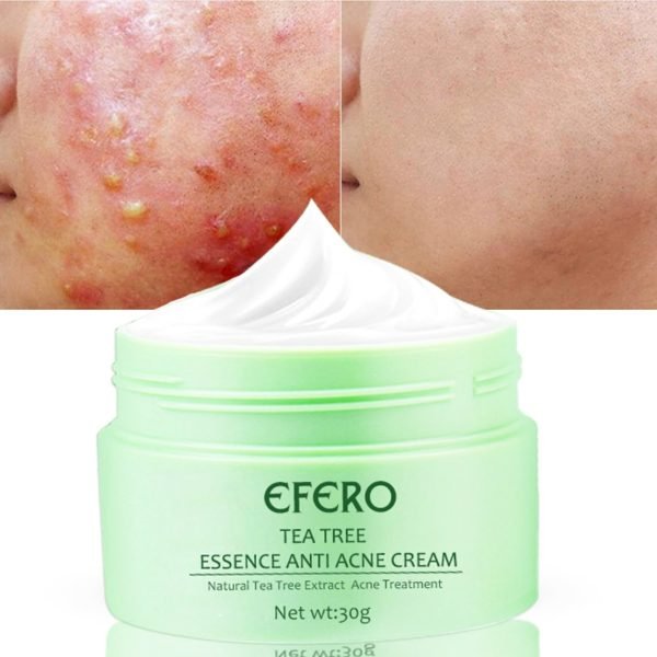 EFERO Tea Tree Anti Acne Face Cream Oil Control Shrink Pores Acne Cream Anti Pimple Whitening 4