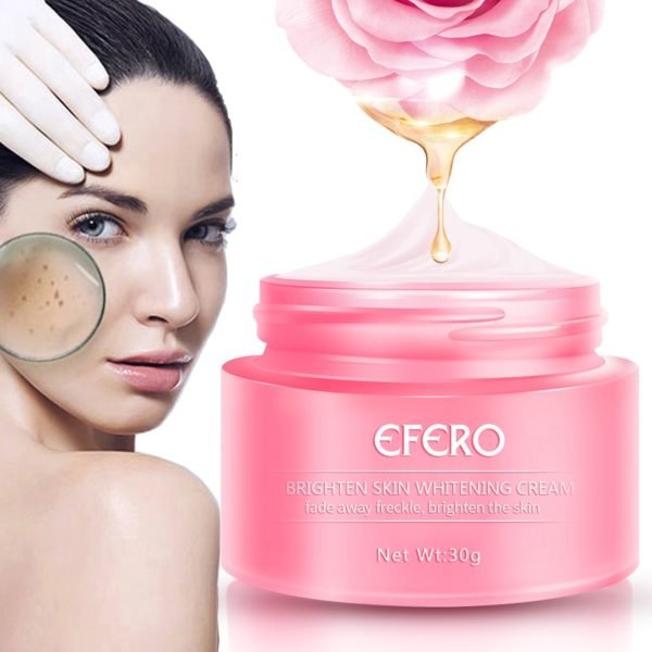 EFERO Whitening Cream Freckles Cream Pigmentation Melasma Removal Skin Lightening for Dark Spot Manchas Remover for 1