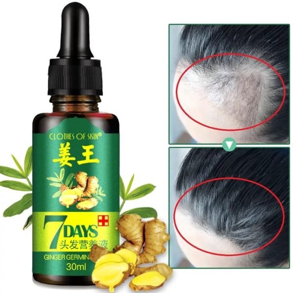 Natural Repair Fast Hair Growth Fluid Hair Loss Treatment Healthy Hair Growth Liquid Biotin Essence 1
