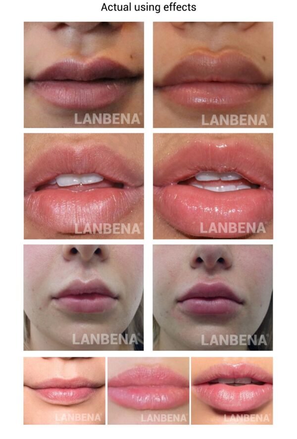 LANBENA 4 5ml Moisturizing Lipgloss Essence Gives A Plump Reduce Lip Wrinkles Lip Care Serum Mask 3