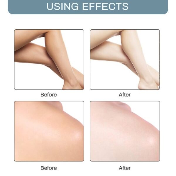 Underarm Whitening Cream Armpit Whitening Cream Legs Knees Private Parts Body Whitening Cream Korean Cosmetics Skin 4
