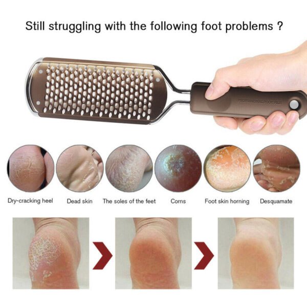 Stainless Foot File Callus Dead Skin Remover Rasp Scraper Cracked Exfoliating Scrub Practical Pedicure Mesh Tools 2