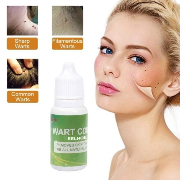 Mole Elimination Potion Skin Dark Spots Remover Lighten Melanin Face Essential Oil Serum Facial Acne Repair 4
