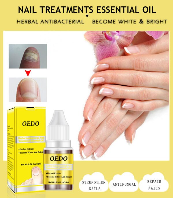 OEDO 10ml Nail Treatment Oil Effective Fungus Removal Nail Foot Whitening Toe Nail Removal Moisturizing Foot 2