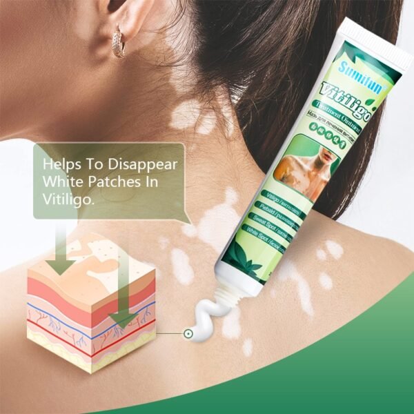 1Box Sumifun New Vitiligo Treatment Ointment Leukoplakia Disease White Spot Skin Repair Cream Pigment Melanin Medical 1