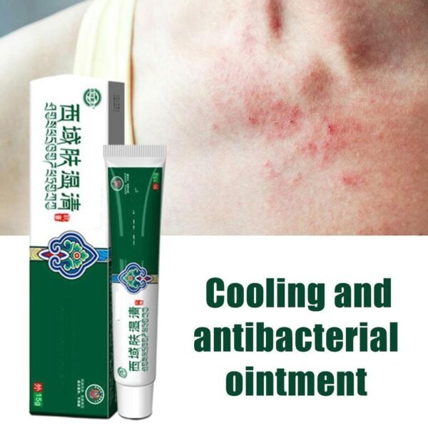 Body Psoriasis Cream Antibacterial Dermatitis Treatment Antipruritic Cooling Ointment Anti itch Relief Skin Rash Allergies Cream