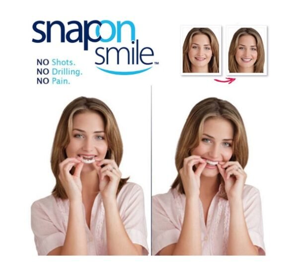 Snapon Smile Simulated Braces Whitening Tooth Sticker Clean Oral 4