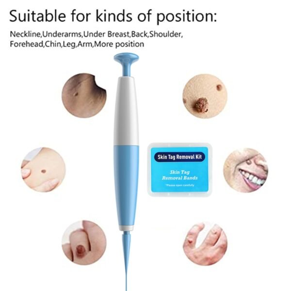 Auto Band Non Toxic Face Care Mole Wart Tool For Small To Medium Blue Skin Tag 4