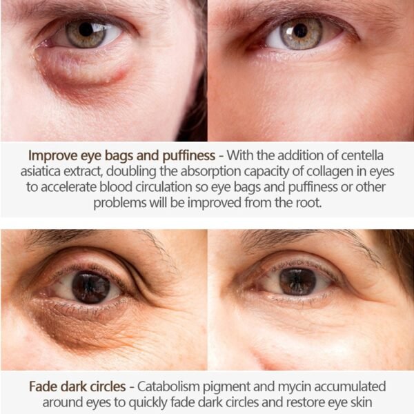 Peptide Collagen Eye Cream Anti Wrinkle Remove Eye Bags Anti Dark Circles Eye Care Essence Against 2