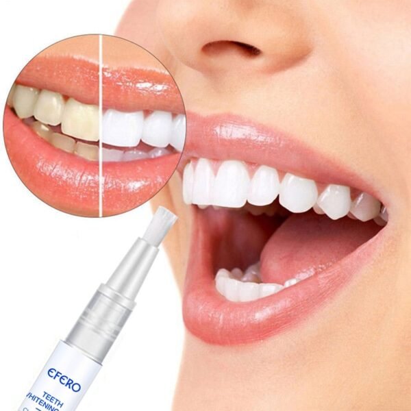 EFERO Teeth Whitening Pen Cleaning Serum Remove Plaque Stains Dental Tools Whiten Teeth Oral Hygiene Tooth 4