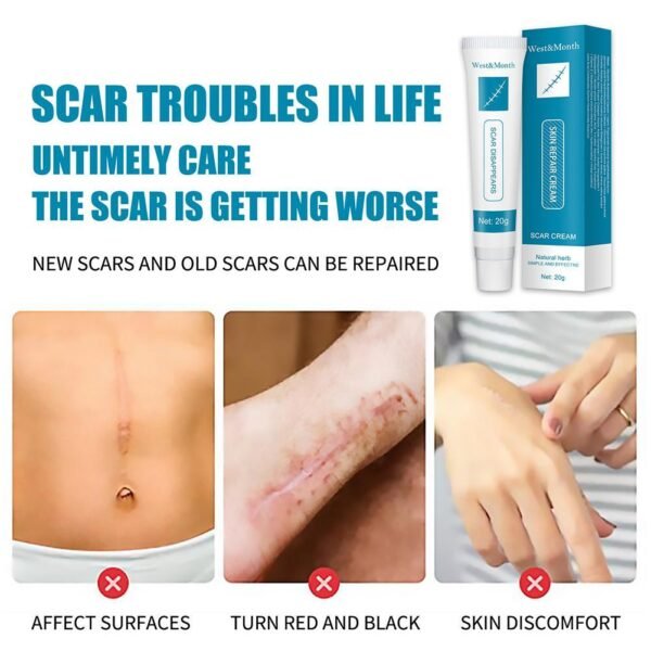 20g Acne Scar Removal Cream Repair Burn Surgical Scars Stretch Marks Promote Cell Regeneration Repair Treatment 2