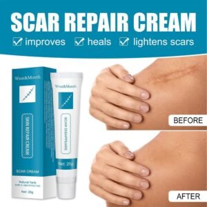 20g Acne Scar Removal Cream Repair Burn Surgical Scars Stretch Marks Promote Cell Regeneration Repair Treatment