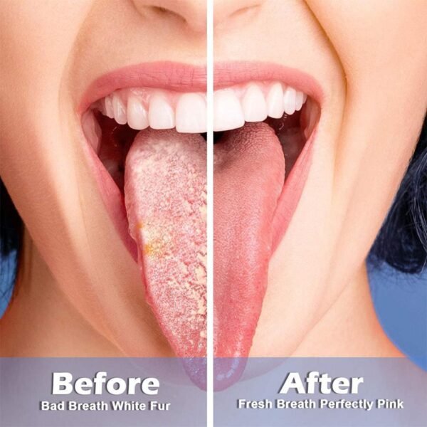 Tongue Scraper And Coating Cleaning Gel Fresh Remove Odor To Cleaner For Bad Breath Cleaning Products 1