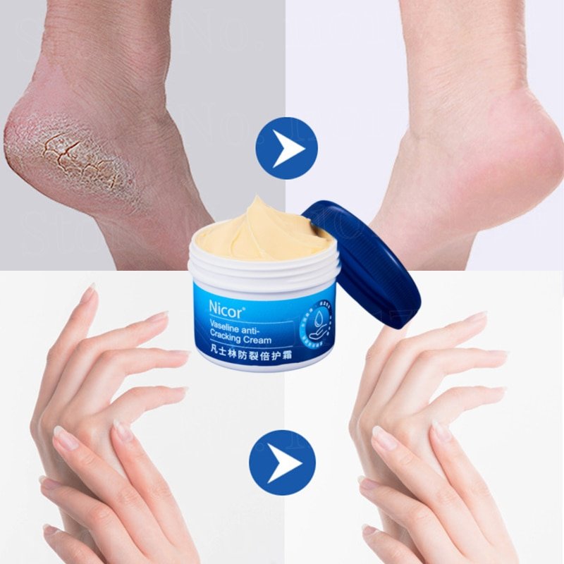 Vaseline Anti cracking Special Cream Hand and Foot Anti freezing Cream Moisturizing Anti freezing Anti drying 2